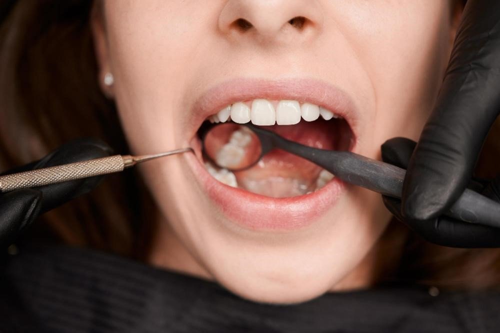 Missing Teeth Solutions